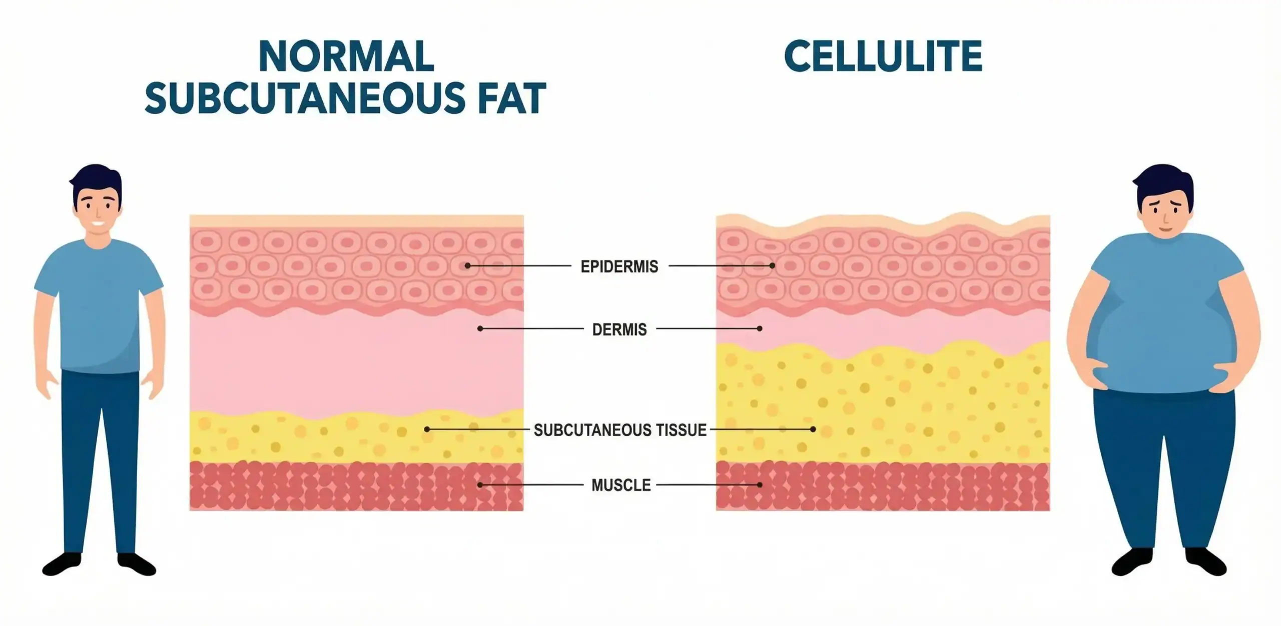 How Can I Lose Belly Fat Without Exercise